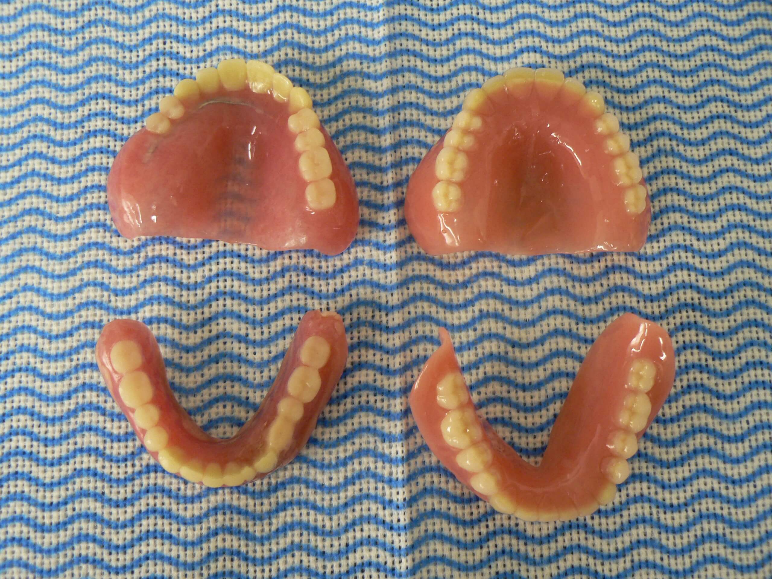 新しい総義歯（総入れ歯）システムについて