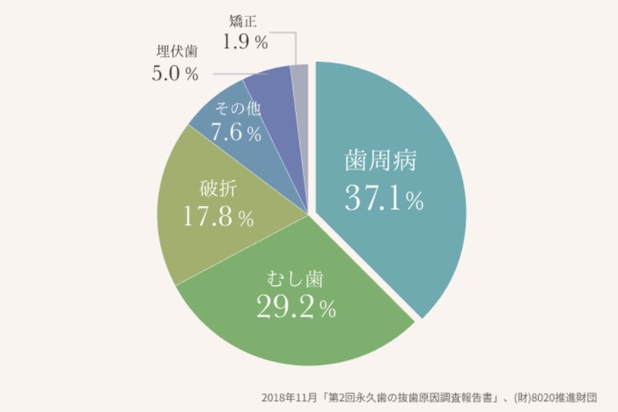 永久歯の抜歯原因調査報告書